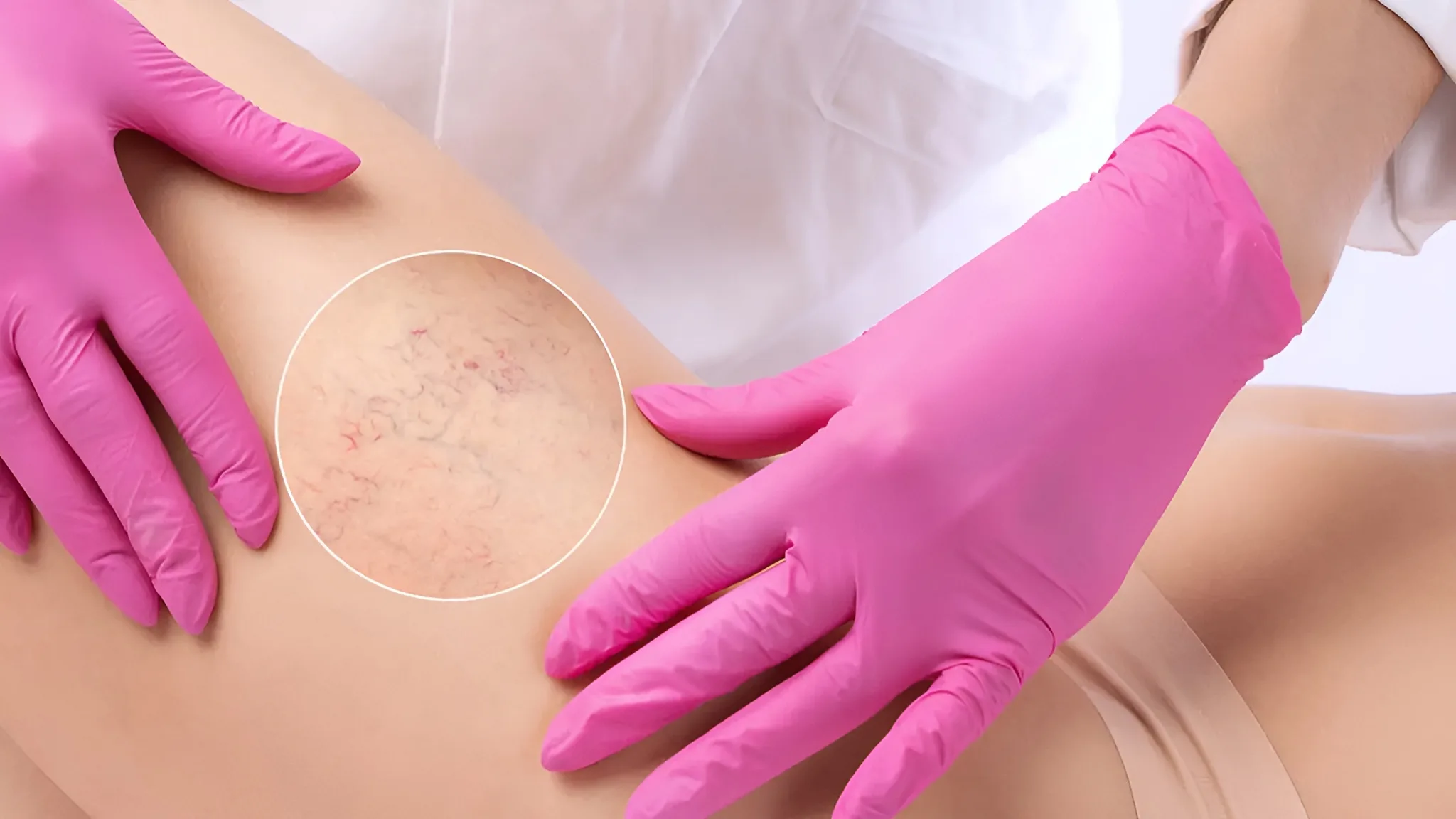 Image of a woman getting her spider veins inspected by a doctor. Find out if vitamin K cream for spider veins is effective.