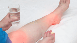 A picture of a woman taking some vitamins for varicose veins.